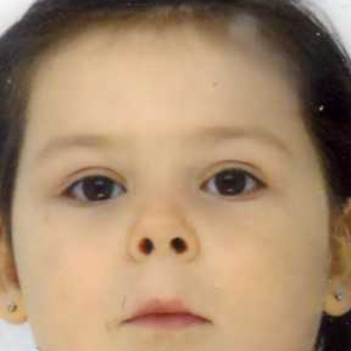 Coline